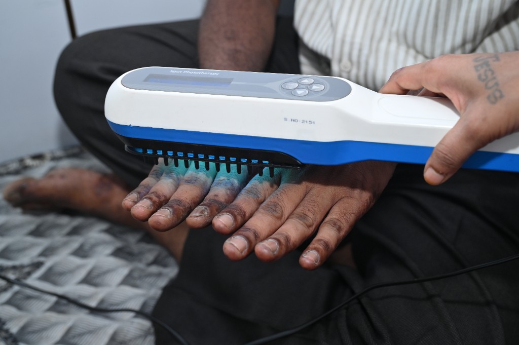 Spot phototherapy